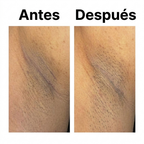 Glycolic Acid Exfoliating Body Stick